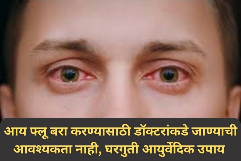 Ayurvedic Remedy For Eye Flu 
